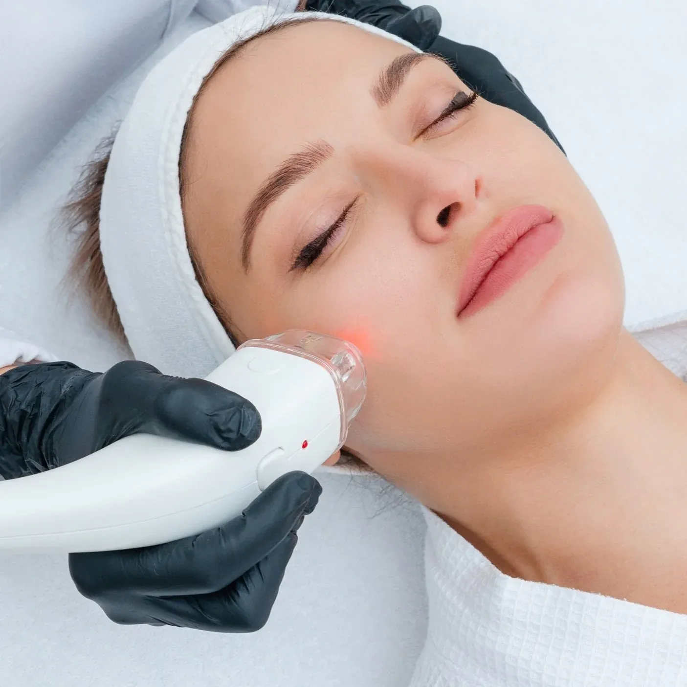 SKIN REJUVENATION
