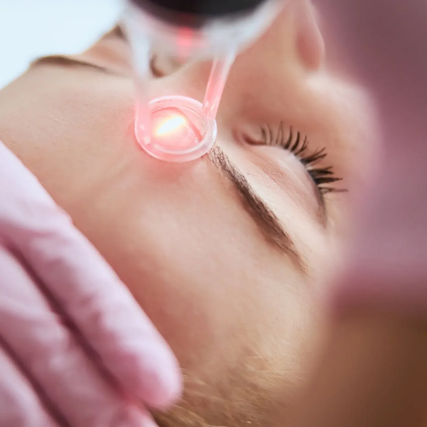 SKIN REJUVENATION

