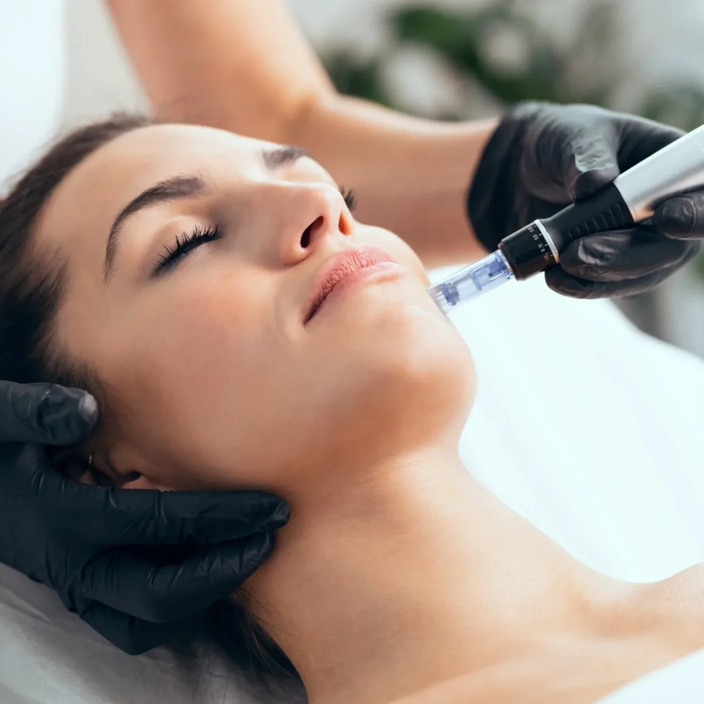 SKIN REJUVENATION
